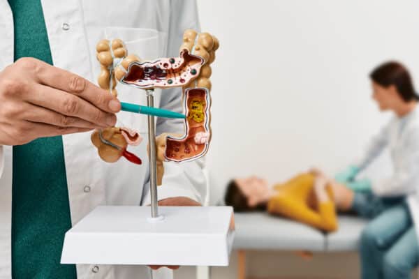 Intestines model, doctor checking stomach symptoms