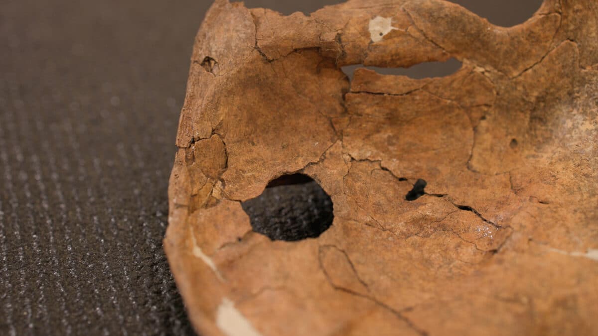 Scapula 5 copy