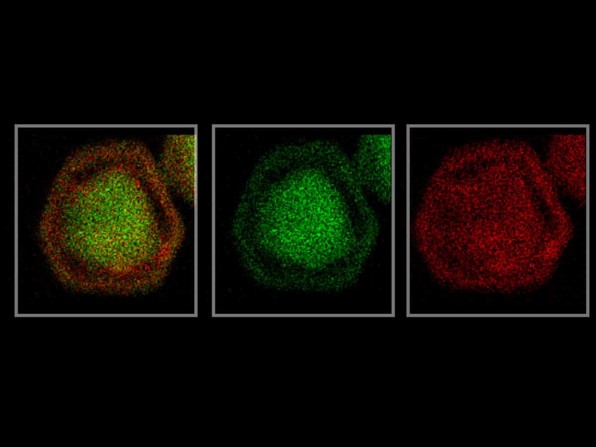 nanoparticle syphilis test
