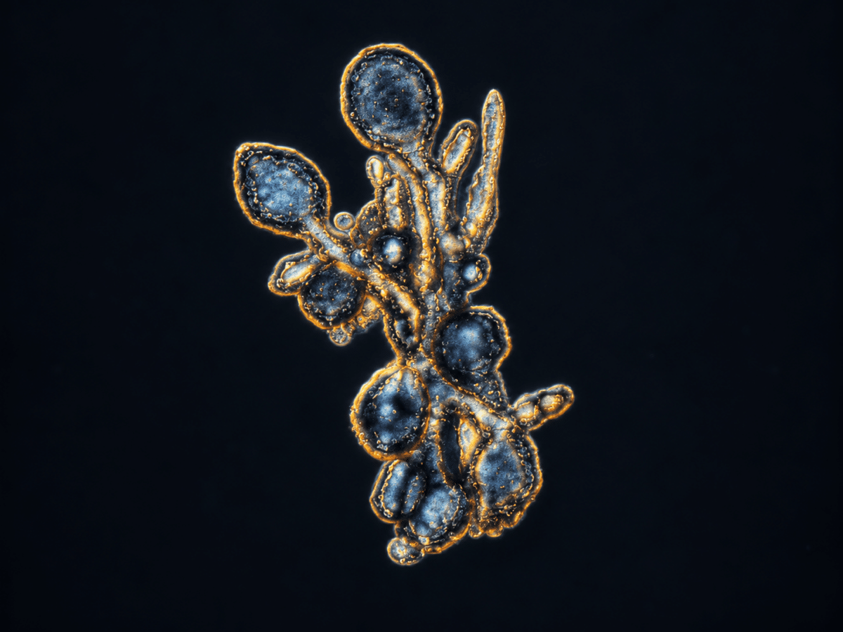 organoid