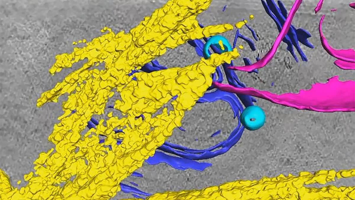 zi-mallen_fitzpatrick-fibrils